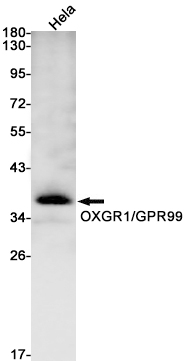 Western blot detection of OXGR1/GPR99 in Hela cell lysates using OXGR1/GPR99 Rabbit mAb(1:1000 diluted).Predicted band size:38kDa.Observed band size:38kDa.