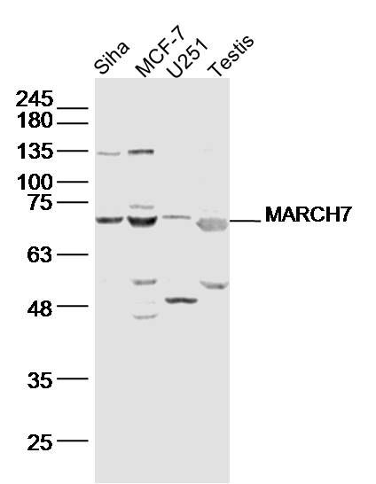 Fig5: Sample:; Siha(human)cell Lysate at 30 ug; MCF-7(human)cell Lysate at 30 ug; U251(human)cell Lysate at 30 ug; testis(rat) Lysate at 40 ug; Primary: Anti-MARCH7 at 1/300 dilution; Secondary: IRDye800CW Goat Anti-Rabbit IgG at 1/20000 dilution; Predicted band size: 78kD; Observed band size: 73 kD