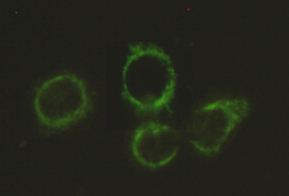 Immunocytochemistry stain of Hela using Pyruvate Dehydrogenase E2 mouse mAb (1:300).