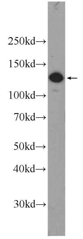 BGC-823 cells were subjected to SDS PAGE followed by western blot with Catalog No:114857(RTEL1 Antibody) at dilution of 1:600