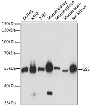 Western blot - GSS Polyclonal Antibody 