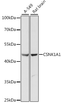 Western blot - CSNK1A1 Polyclonal Antibody 