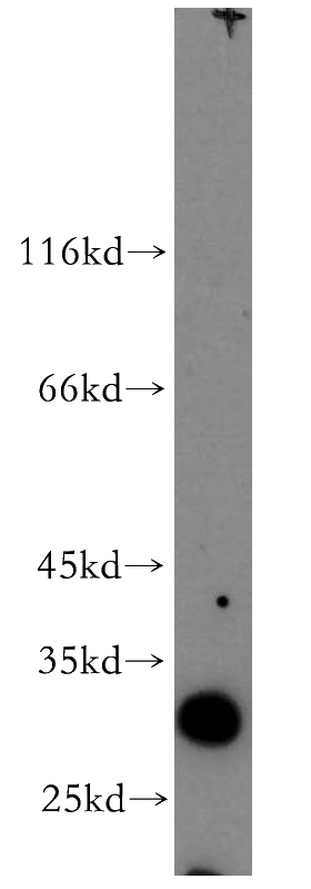 human kidney tissue were subjected to SDS PAGE followed by western blot with Catalog No:115306(SLC17A5 antibody) at dilution of 1:300