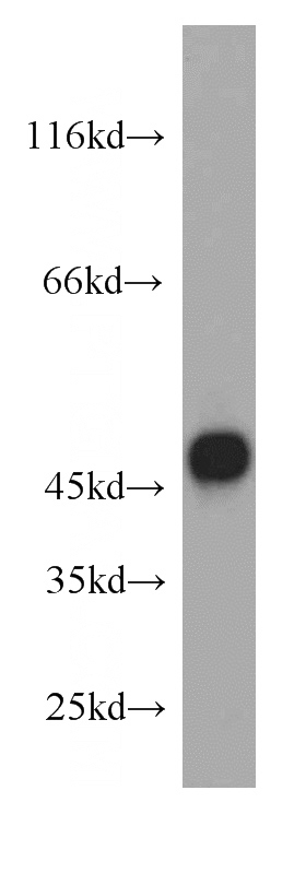 L02 cells were subjected to SDS PAGE followed by western blot with Catalog No:110450(FADS3 antibody) at dilution of 1:300