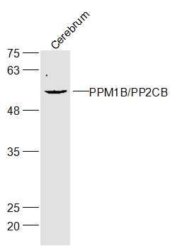 Fig4: Sample:; Cerebrum (Mouse) Lysate at 40 ug; Primary: Anti-Gliomedin at 1/300 dilution; Secondary: IRDye800CW Goat Anti-Rabbit IgG at 1/20000 dilution; Predicted band size: 59 kD; Observed band size: 59 kD