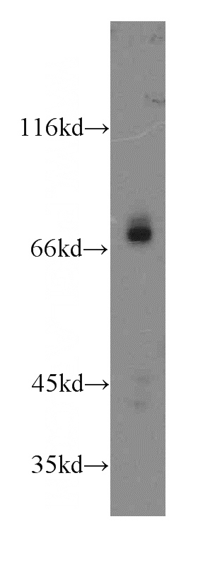 MCF7 cells were subjected to SDS PAGE followed by western blot with Catalog No:111004(GNL1 antibody) at dilution of 1:300
