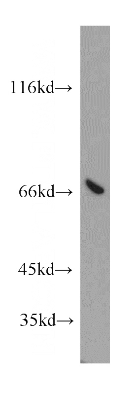 HeLa cells were subjected to SDS PAGE followed by western blot with Catalog No:108304(ATP6V1A antibody) at dilution of 1:500