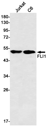 Western blot detection of FLI1 in Jurkat,C6 cell lysates using FLI1 Rabbit mAb(1:500 diluted).Predicted band size:51kDa.Observed band size:51kDa.