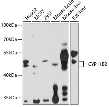 Western blot - CYP11B2 Polyclonal Antibody 