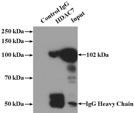 IP Result of anti-HDAC7 (IP:Catalog No:111382, 4ug; Detection:Catalog No:111382 1:300) with K-562 cells lysate 4000ug.