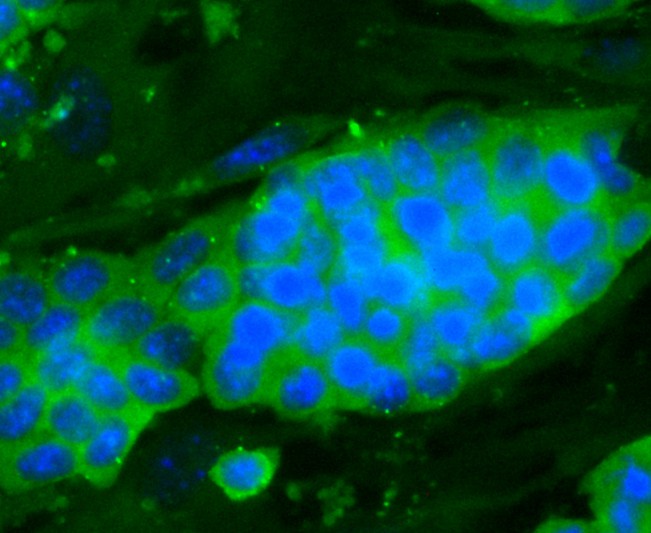 Fig2: ICC staining Dopey-2 in D3 cells (green). The nuclear counter stain is DAPI (blue). Cells were fixed in paraformaldehyde, permeabilised with 0.25% Triton X100/PBS.