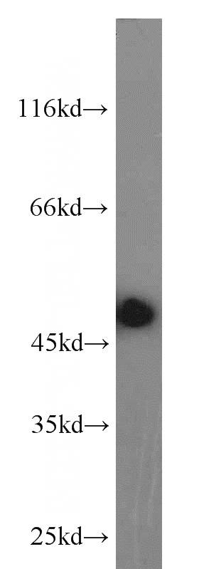 HeLa cells were subjected to SDS PAGE followed by western blot with Catalog No:113830(phospho-CHC1(Ser12) antibody) at dilution of 1:300