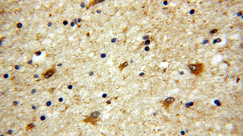 Immunohistochemical of paraffin-embedded human brain using Catalog No:111450(HPRT1 antibody) at dilution of 1:100 (under 40x lens)