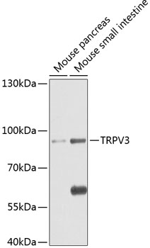 Western blot - TRPV3 Polyclonal Antibody 