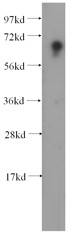 mouse skeletal muscle tissue were subjected to SDS PAGE followed by western blot with Catalog No:111356(HIRIP3 antibody) at dilution of 1:300