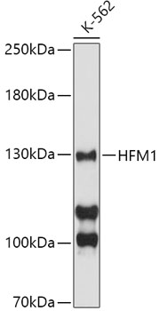 Western blot - HFM1 Polyclonal Antibody 