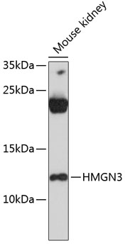 Western blot - HMGN3 Polyclonal Antibody 