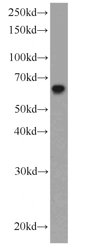 HeLa cells were subjected to SDS PAGE followed by western blot with Catalog No:113765(PDCD4 antibody) at dilution of 1:3000