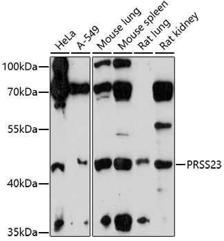Western blot - PRSS23 Polyclonal Antibody 