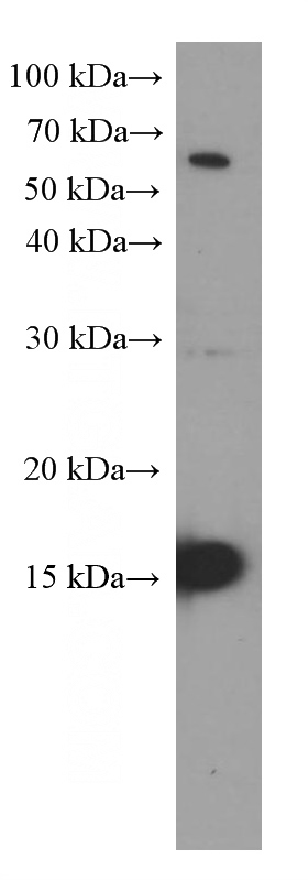 LPS treated RAW 264.7 cells were subjected to SDS PAGE followed by western blot with Catalog No:107420(Mcp1 Antibody) at dilution of 1:1000