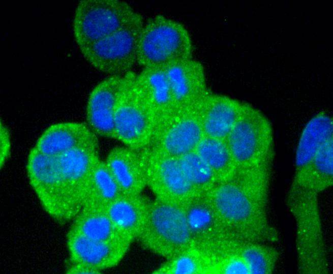Fig5:; ICC staining of Vitronectin in MCF-7 cells (green). Formalin fixed cells were permeabilized with 0.1% Triton X-100 in TBS for 10 minutes at room temperature and blocked with 1% Blocker BSA for 15 minutes at room temperature. Cells were probed with the primary antibody ( 1/50) for 1 hour at room temperature, washed with PBS. Alexa Fluor®488 Goat anti-Rabbit IgG was used as the secondary antibody at 1/1,000 dilution. The nuclear counter stain is DAPI (blue).
