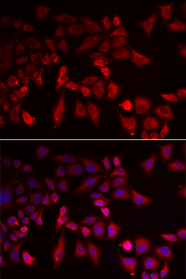 Immunofluorescence - PYGL Polyclonal Antibody 