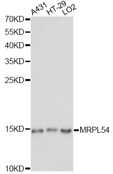 Western blot - MRPL54 Polyclonal Antibody 