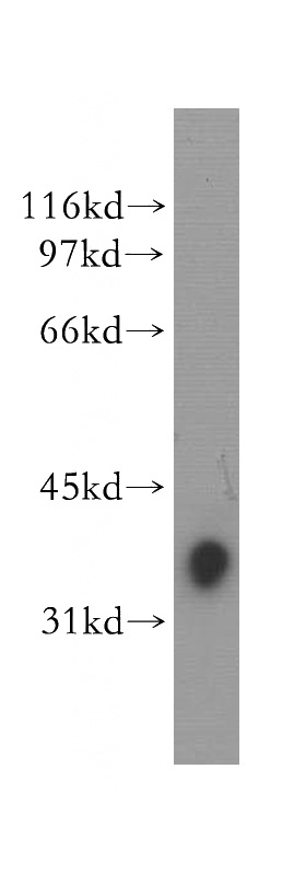 Jurkat cells were subjected to SDS PAGE followed by western blot with Catalog No:115296(SLAMF7 antibody) at dilution of 1:300