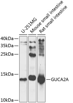 Western blot - GUCA2A Polyclonal Antibody 