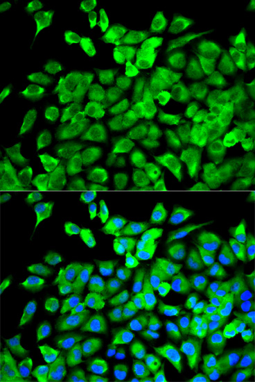 Immunofluorescence - EIF4A1 Polyclonal Antibody 