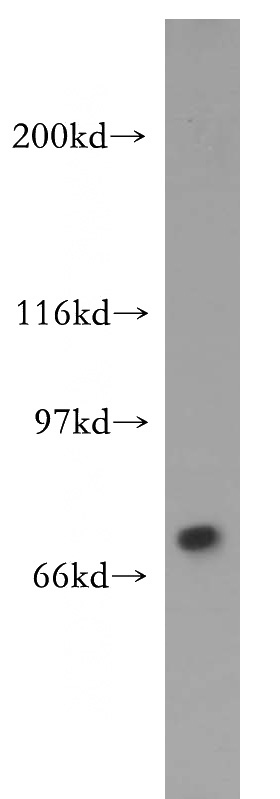 HepG2 cells were subjected to SDS PAGE followed by western blot with Catalog No:116124(TIGD1 antibody) at dilution of 1:400