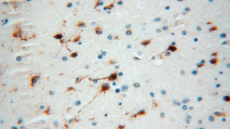 Immunohistochemical of paraffin-embedded human brain using Catalog No:114303(PSG11 antibody) at dilution of 1:100 (under 40x lens)