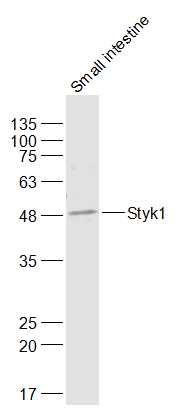 Fig2: Sample:; Small intestine (Mouse) Lysate at 40 ug; Primary: Anti-Styk1 at 1/300 dilution; Secondary: IRDye800CW Goat Anti-Rabbit IgG at 1/20000 dilution; Predicted band size: 48 kD; Observed band size: 48 kD