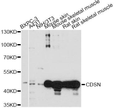 Western blot - CDSN Polyclonal Antibody 