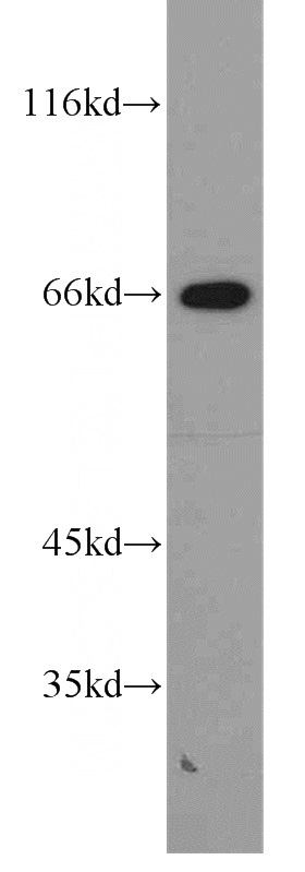 K-562 cells were subjected to SDS PAGE followed by western blot with Catalog No:115810(STXBP2 antibody) at dilution of 1:1000