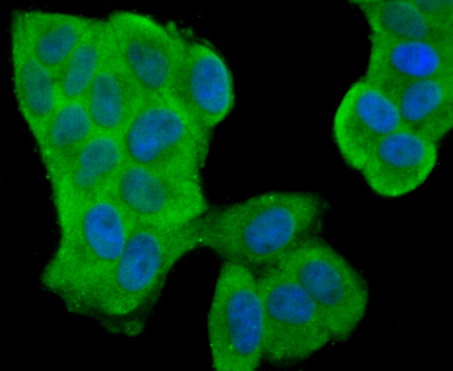 Fig2: ICC staining FPR1 in Hela cells (green). The nuclear counter stain is DAPI (blue). Cells were fixed in paraformaldehyde, permeabilised with 0.25% Triton X100/PBS.