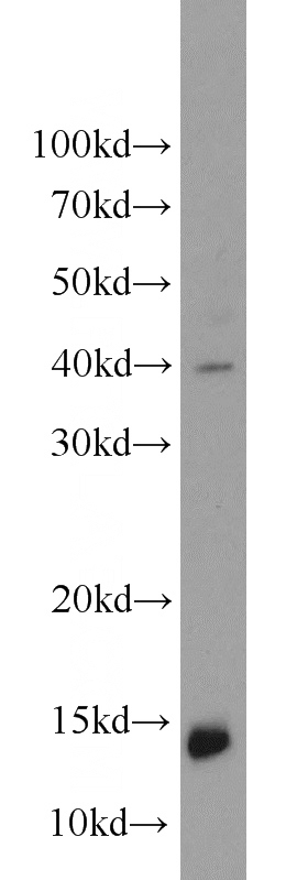 mouse brain tissue were subjected to SDS PAGE followed by western blot with Catalog No:113128(NRGN antibody) at dilution of 1:1000