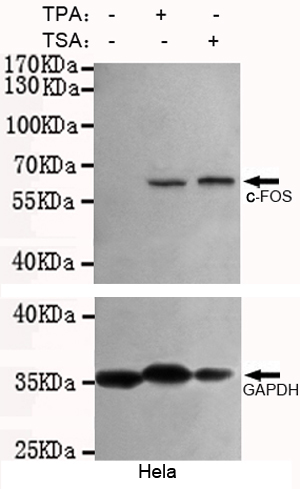 Western blot analysis of extracts from Hela cells,untreated,50 u03bcM TSA-treated or 50 u03bcM TPA-treated for 24h,using C-FOS antibody (1:500 diluted)(upper) or GAPDH antibody (1:10000 diluted) (lower).