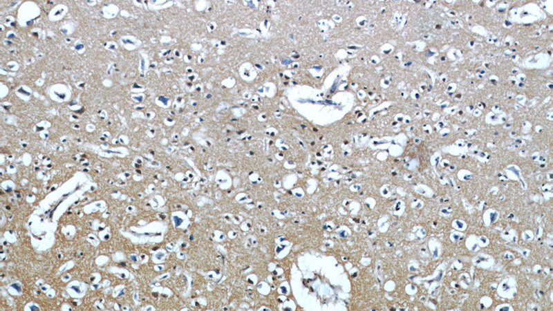 Immunohistochemical of paraffin-embedded human brain using Catalog No:111785(IMPDH2 antibody) at dilution of 1:50 (under 10x lens)