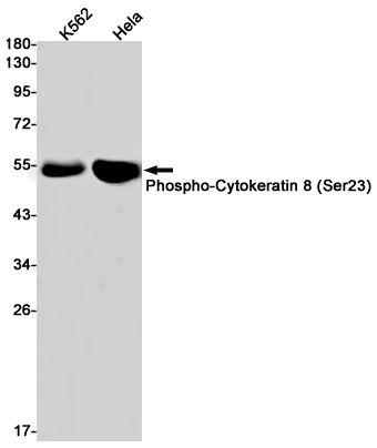 Western blot detection of Phospho-Cytokeratin 8 (Ser23) in K562,Hela cell lysates using Phospho-Cytokeratin 8 (Ser23) Rabbit pAb(1:1000 diluted).Predicted band size:54kDa.Observed band size:54kDa.