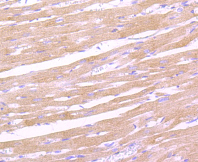 Fig4:; Immunohistochemical analysis of paraffin-embedded rat heart tissue using anti-Leptin Receptor antibody. The section was pre-treated using heat mediated antigen retrieval with Tris-EDTA buffer (pH 8.0-8.4) for 20 minutes.The tissues were blocked in 5% BSA for 30 minutes at room temperature, washed with ddH; 2; O and PBS, and then probed with the primary antibody ( 1/50) for 30 minutes at room temperature. The detection was performed using an HRP conjugated compact polymer system. DAB was used as the chromogen. Tissues were counterstained with hematoxylin and mounted with DPX.