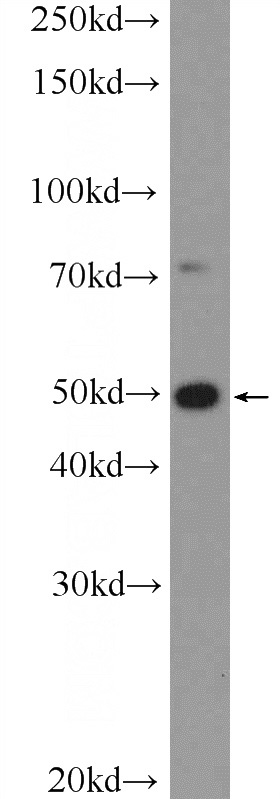 BGC-823 cells were subjected to SDS PAGE followed by western blot with Catalog No:113640(PDX1 Antibody) at dilution of 1:600