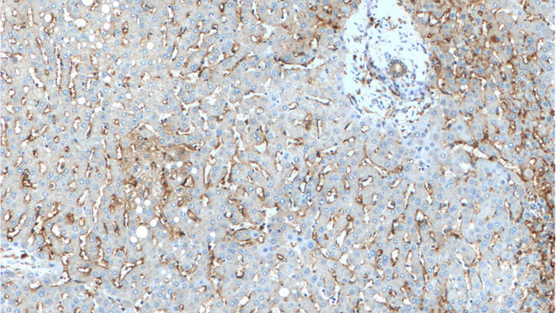 Immunohistochemistry of paraffin-embedded human liver tissue slide using Catalog No:109053(CD14 Antibody) at dilution of 1:200 (under 10x lens).