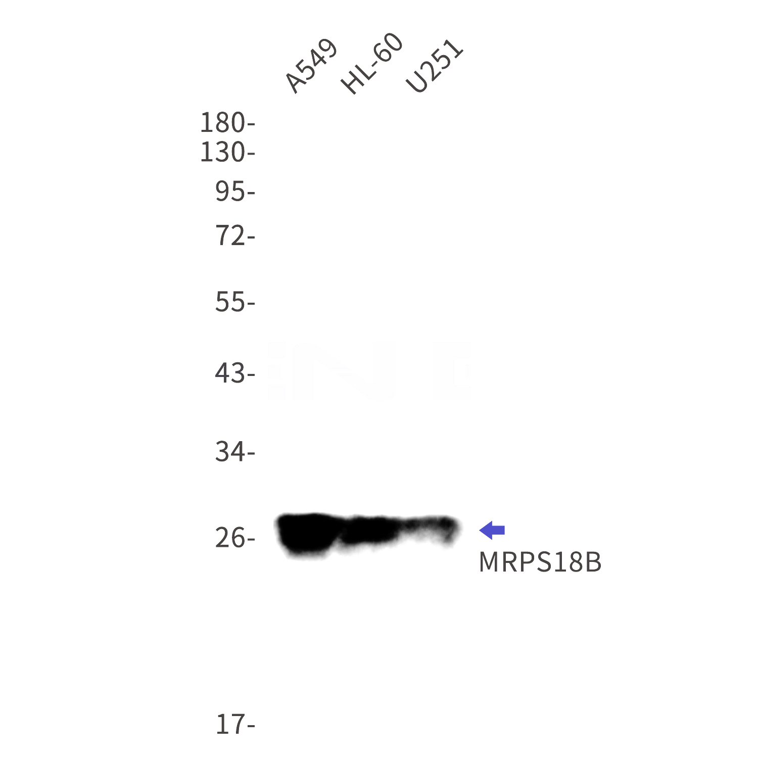 Western blot detection of MRPS18B in A549,HL-60,U251 cell lysates using MRPS18B Rabbit mAb(1:1000 diluted).Predicted band size:29kDa.Observed band size:29kDa.