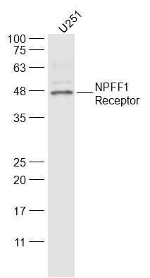 Fig2: Sample:; U251(Human) Cell Lysate at 30 ug; Primary: Anti-NPFF1 Receptor at 1/300 dilution; Secondary: IRDye800CW Goat Anti-Rabbit IgG at 1/20000 dilution; Predicted band size: 48 kD; Observed band size: 48 kD