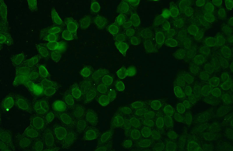 Immunofluorescent analysis of HeLa cells using Catalog No:116094(TMEM120A Antibody) at dilution of 1:25 and Alexa Fluor 488-congugated AffiniPure Goat Anti-Rabbit IgG(H+L)