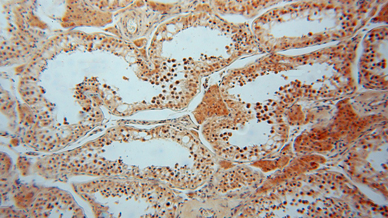 Immunohistochemical of paraffin-embedded human testis using Catalog No:115406(SMYD1-Specific antibody) at dilution of 1:50 (under 10x lens)
