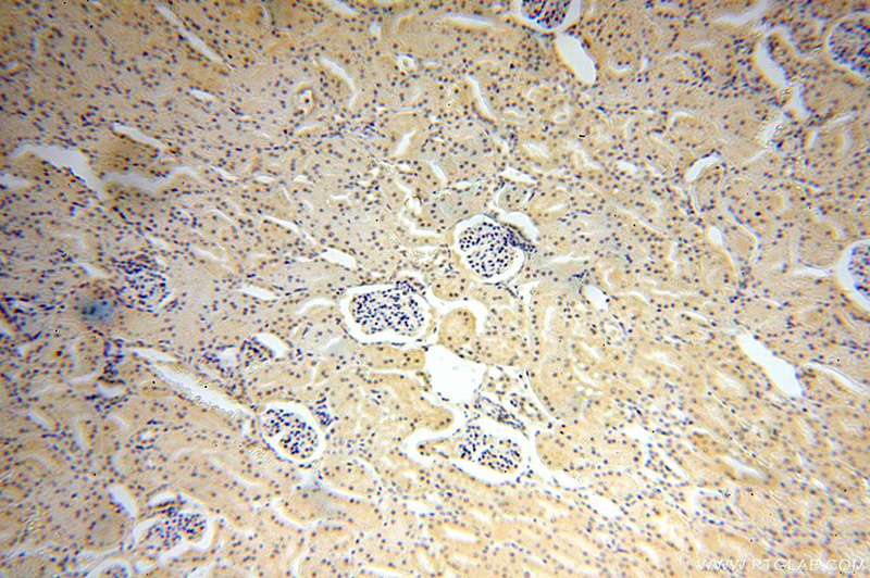 Immunohistochemical of paraffin-embedded human kidney using Catalog No:115888(TBX2 antibody) at dilution of 1:100 (under 10x lens)
