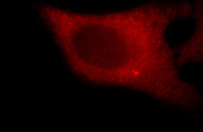 Immunofluorescent analysis of Hela cells, using C11orf70 antibody Catalog No:108643 at 1:25 dilution and Rhodamine-labeled goat anti-rabbit IgG (red).