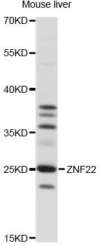 Western blot - ZNF22 Polyclonal Antibody 
